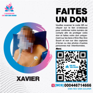 Xavier, 62, amputee and looking to buy a wheelchair