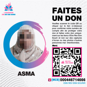 Asma, 55 ans, doit subir une chirurgie pour des veines variqueuses dans le membre inférieur droit.