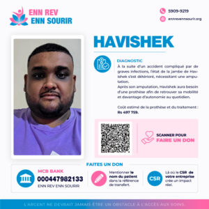 Havishek 31 years old, needs a prosthesis