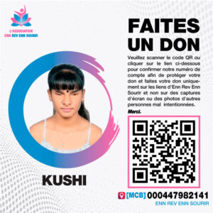 Kushi, 20 ans, souffre d’un absence complète du globe oculaire aux deux yeux