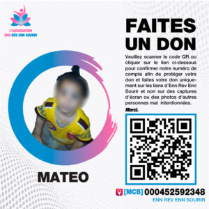 Mateo 1 year old , need to undergo COMPLEX HYPOSPADIAS Surgery