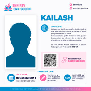 Kailash 45 Years Old, Suffers from Keratoconus