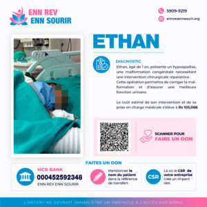 Ethan,1 yrs old,suffering a hypospadias