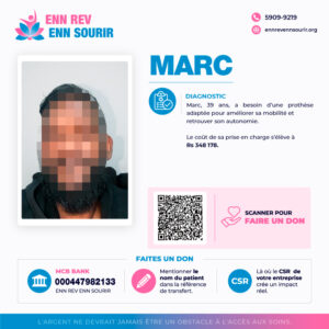 Marc,39 ans, a besoin d'une prothèse